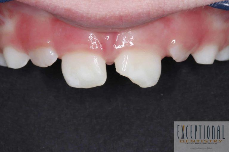 Before Image