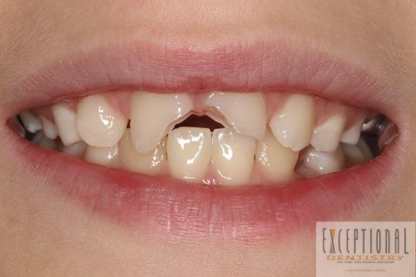 Before Image