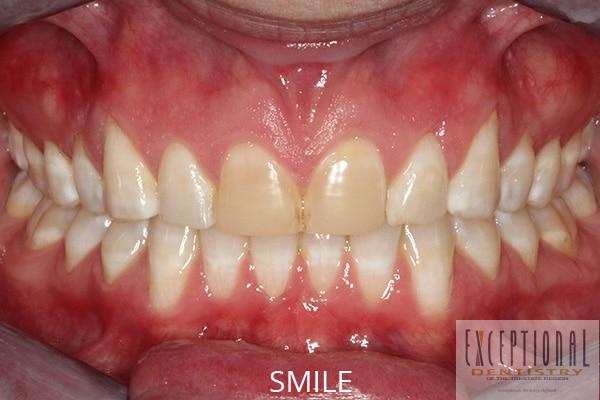 Before Image