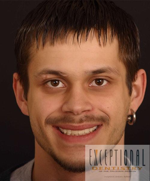 After Image