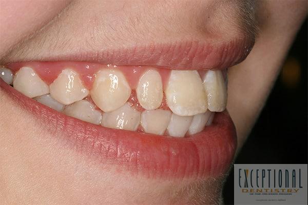 Before Image