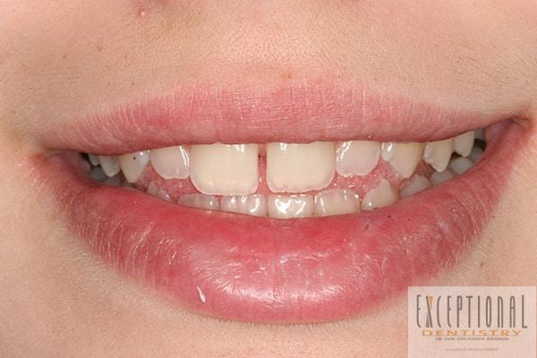 Before Image